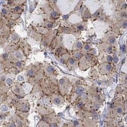 Cannabinoid R1/CB1/CNR1 Rabbit anti-Human, Polyclonal, Novus Biologicals:Antibodies:Primary