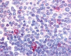 Cannabinoid R2/CB2/CNR2 Antibody - BSA Free, Novus Biologicals 0.05 mL | Buy Online | Novus Biologicals | Fisher Scientific