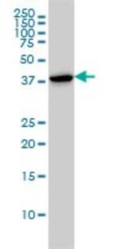 CapG Antibody (1F1), Novus Biologicals 100 &mu;g | Buy Online | Novus Biologicals | Fisher Scientific
