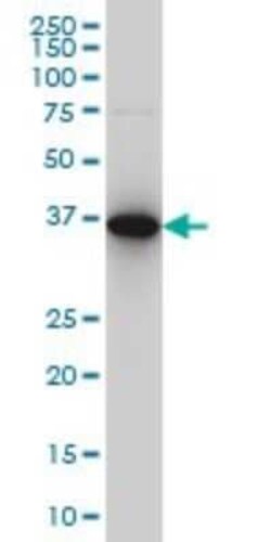 Novus Biologicals CapG Antibody (6D6), Novus Biologicals 0.1 mg | Buy Online | Novus Biologicals&trade; | Fisher Scientific