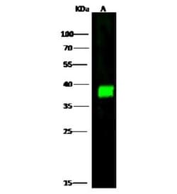 CapG Antibody, Novus Biologicals:Anticorps:Anticorps primaires