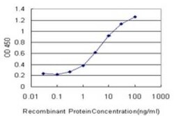 Carbohydrate Sulfotransferase 3/CHST3 Antibody (1C4), Novus Biologicals 0.1 mg | Buy Online | Novus Biologicals | Fisher Scientific