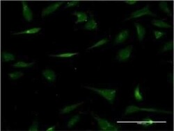 Carbohydrate Sulfotransferase 3/CHST3 Antibody (1D3), Novus Biologicals 0.1 mg | Buy Online | Novus Biologicals | Fisher Scientific