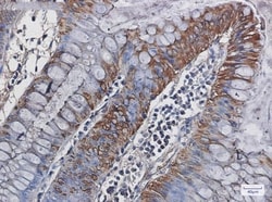 Carbonic Anhydrase I/CA1 Antibody (S03-8F1), Novus Biologicals:Antibodies:Primary