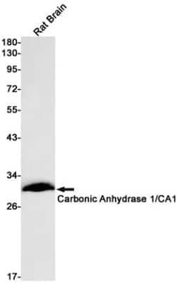 Carbonic Anhydrase I/CA1 Antibody (S03-8F1), Novus Biologicals:Antibodies:Primary