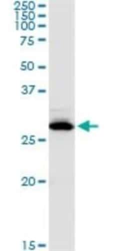Carbonic Anhydrase I/CA1 Antibody, Novus Biologicals 0.1 mg; Unconjugated:Antibodies,