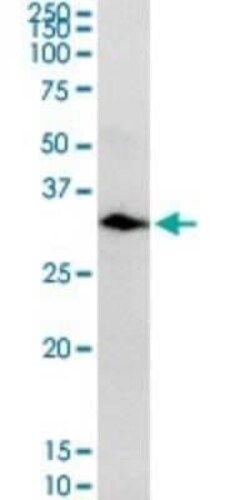 Carbonic Anhydrase I/CA1 Antibody, Novus Biologicals 0.1 mg; Unconjugated:Antibodies,