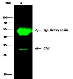 Carbonic Anhydrase II/CA2 Rabbit anti-Human, Clone: 1, Novus Biologicals