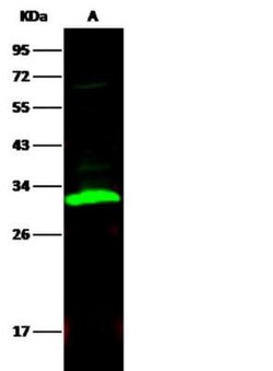 Carbonic Anhydrase II/CA2 Rabbit anti-Human, Clone: 1, Novus Biologicals