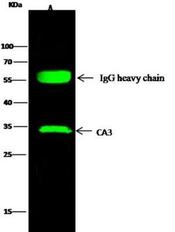 Carbonic Anhydrase III/CA3 Rabbit anti-Human, Clone: 6, Novus Biologicals