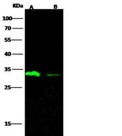 Carbonic Anhydrase III/CA3 Rabbit anti-Human, Clone: 6, Novus Biologicals