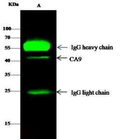 Carbonic Anhydrase IX/CA9 Rabbit anti-Human, Clone: 3, Novus Biologicals