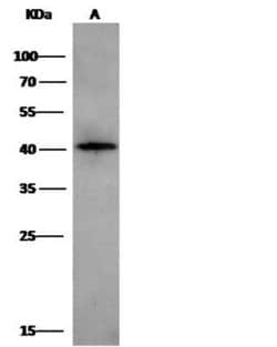 Carbonic Anhydrase IX/CA9 Rabbit anti-Human, Clone: 3, Novus Biologicals