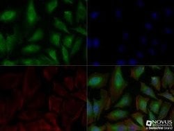 Carbonic Anhydrase IX/CA9 Antibody (2D3) - Azide and BSA Free, Novus Biologicals