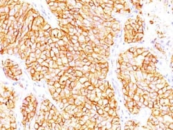 Carbonic Anhydrase IX/CA9 Antibody (66.4.C2 (PN-15)), Novus Biologicals
