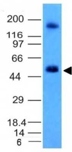 Carbonic Anhydrase IX/CA9 Antibody (CA9/781), Novus Biologicals:Antibodies:Primary