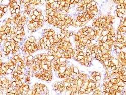 Carbonic Anhydrase IX/CA9 Antibody (PN-15), Novus Biologicals:Antibodies:Primary