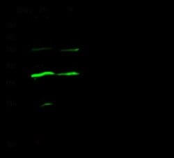 Carbonic Anhydrase VIII/CA8 Rabbit anti-Mouse, Clone: 5, Novus Biologicals