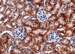 Carbonic Anhydrase XII/CA12 Rabbit anti-Mouse, Clone: 12, Novus Biologicals