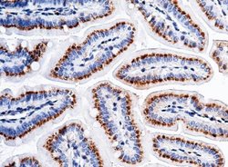 Carbonic Anhydrase XII/CA12 Rabbit anti-Mouse, Clone: 12, Novus Biologicals