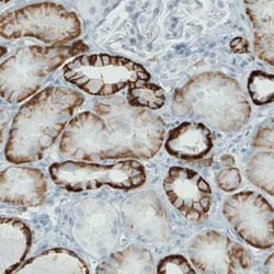 Carbonic Anhydrase XII/CA12 Antibody (CL0278), Novus Biologicals 25 &mu;L,