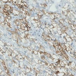 Carbonic Anhydrase XII/CA12 Antibody (CL0278), Novus Biologicals 25 &mu;L,