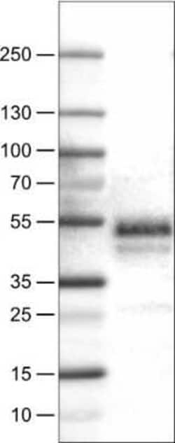 Carbonic Anhydrase XII/CA12 Antibody (CL0278), Novus Biologicals 25 &mu;L,