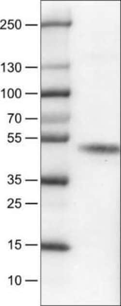 Carbonic Anhydrase XII/CA12 Antibody (CL0280), Novus Biologicals 25 &mu;L,