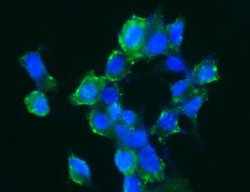 Carbonic Anhydrase XIV/CA14 Rabbit anti-Human, Clone: 515, Novus Biologicals