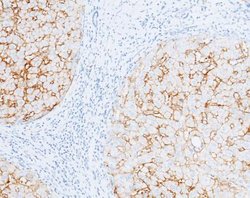 Carbonic Anhydrase XIV/CA14 Rabbit anti-Human, Clone: 515, Novus Biologicals