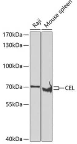 Carboxyl Ester Lipase/CEL Antibody - BSA Free, Novus Biologicals 0.02 mL,