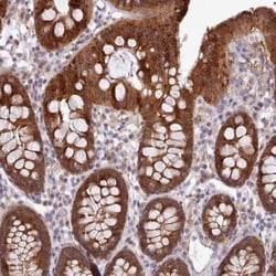 Carboxylesterase 3/CES3/Esterase 31 Antibody, Novus Biologicals 25 &mu;L,