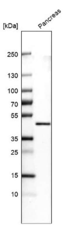 Carboxypeptidase A1/CPA1 Antibody (CL6607), Novus Biologicals:Antibodies:Primary
