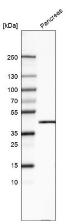 Carboxypeptidase A1/CPA1 Antibody (CL6629), Novus Biologicals 25 &mu;L;