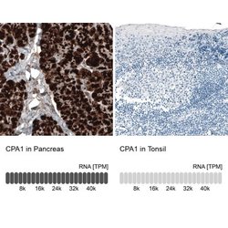 Carboxypeptidase A1/CPA1 Antibody (CL6607), Novus Biologicals:Antibodies:Primary