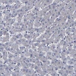Carboxypeptidase A2/CPA2 Antibody, Novus Biologicals 25 &mu;L | Buy Online | Novus Biologicals | Fisher Scientific