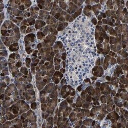 Carboxypeptidase A2/CPA2 Antibody, Novus Biologicals 25 &mu;L | Buy Online | Novus Biologicals | Fisher Scientific