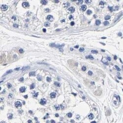 Carboxypeptidase A2/CPA2 Antibody, Novus Biologicals 25 &mu;L | Buy Online | Novus Biologicals | Fisher Scientific