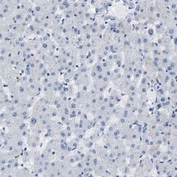 Carboxypeptidase A2/CPA2 Antibody, Novus Biologicals 25 &mu;L; Unconjugated:Antibodies,