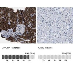 Carboxypeptidase A2/CPA2 Antibody, Novus Biologicals 25 &mu;L; Unconjugated:Antibodies,