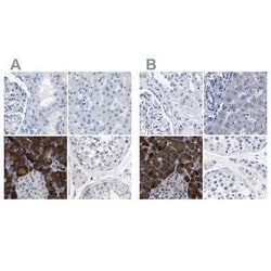 Carboxypeptidase A2/CPA2 Antibody, Novus Biologicals 25 &mu;L; Unconjugated:Antibodies,