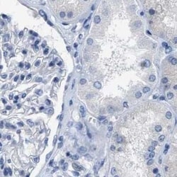 Carboxypeptidase A2/CPA2 Antibody, Novus Biologicals 25 &mu;L; Unconjugated:Antibodies,