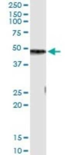 Carboxypeptidase B1/CPB1 Antibody (4D5), Novus Biologicals 0.1 mg | Buy Online | Novus Biologicals | Fisher Scientific