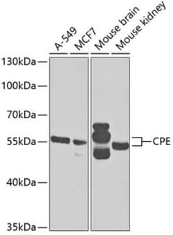 Carboxypeptidase E/CPE Antibody - BSA Free, Novus Biologicals 0.1 mL, Unconjugated:Antibodies,