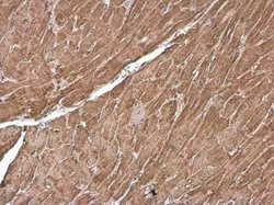 Cardiac Troponin T Antibody, Novus Biologicals 100 &mu;g | Buy Online | Bio-Techne | Fisher Scientific