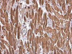 Cardiac Troponin T Antibody, Novus Biologicals 100 &mu;g | Buy Online | Bio-Techne | Fisher Scientific