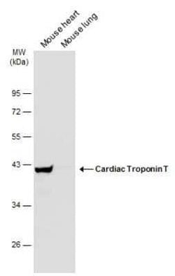 Cardiac Troponin T Antibody, Novus Biologicals 100 μg; Unconjugated:Antibodies,