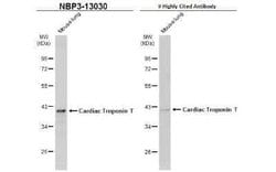 Cardiac Troponin T Antibody, Novus Biologicals 100 μg; Unconjugated:Antibodies,