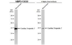 Cardiac Troponin T Antibody, Novus Biologicals 100 μg; Unconjugated:Antibodies,
