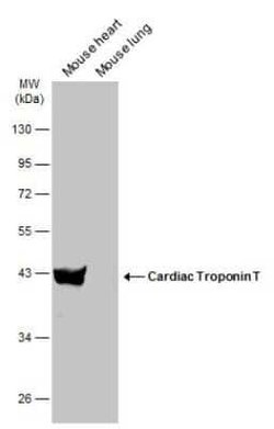 Cardiac Troponin T Antibody, Novus Biologicals 100 &mu;g | Buy Online | Bio-Techne | Fisher Scientific